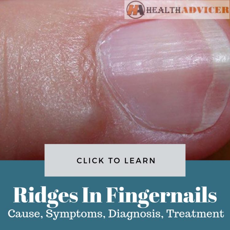 Ridges In Fingernails
