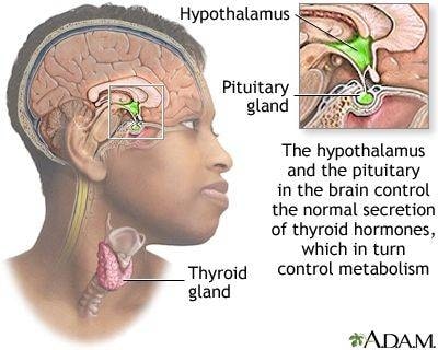 Causes Of Graves Disease