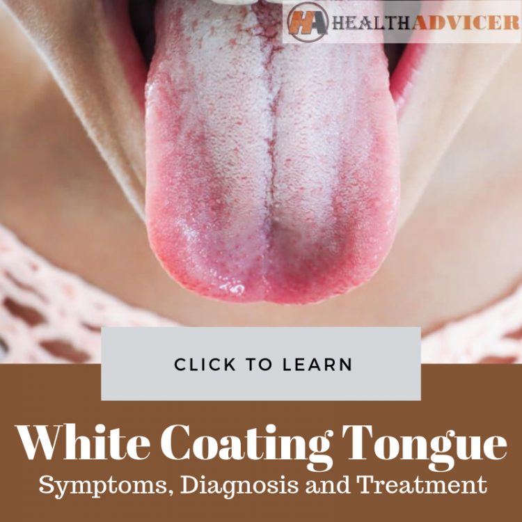 White Coating On Tongue