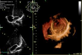 Echocardiograph