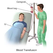 Blood Product Transfusion