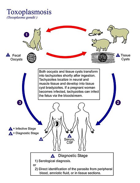 Toxoplasmosis