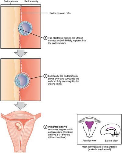 Implantation Cramping