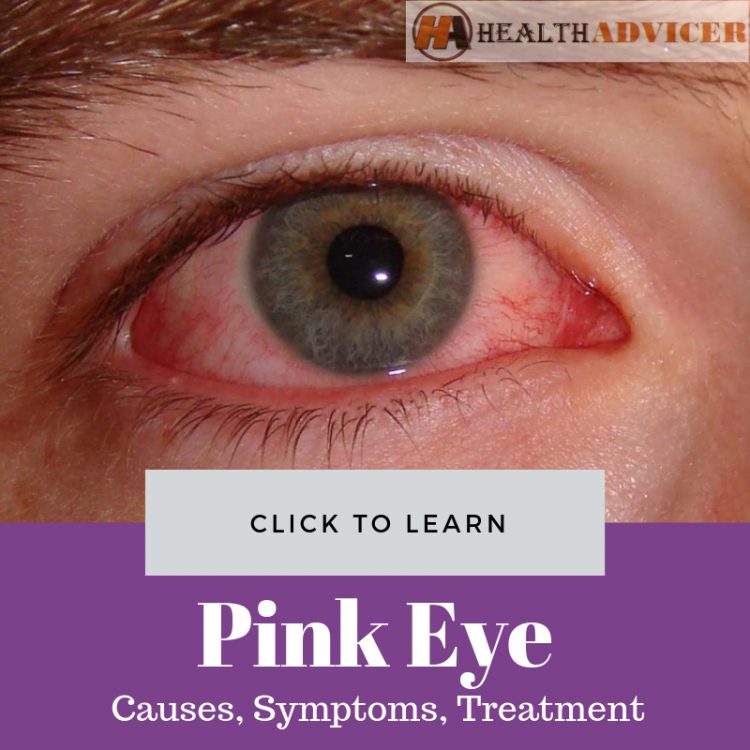 Pink Eye