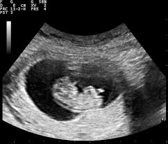 Ultrasound Scans