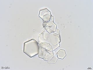 Cysteine Crystals