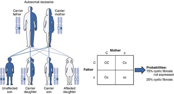 People At Risk Of Getting Affected By Morquio Syndrome