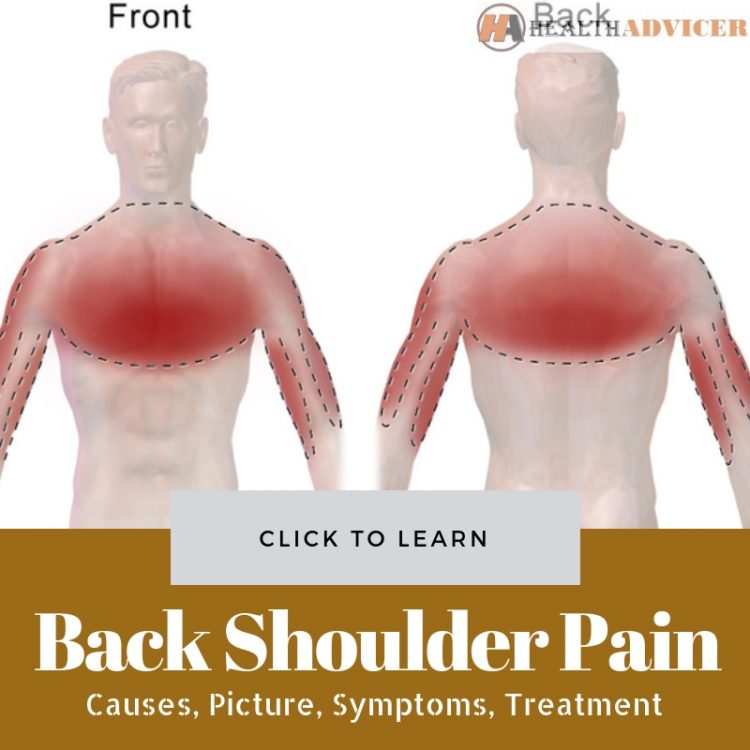 Back Shoulder Pain Causes Treatment