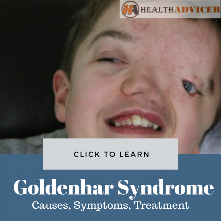 Goldenhar Syndrome