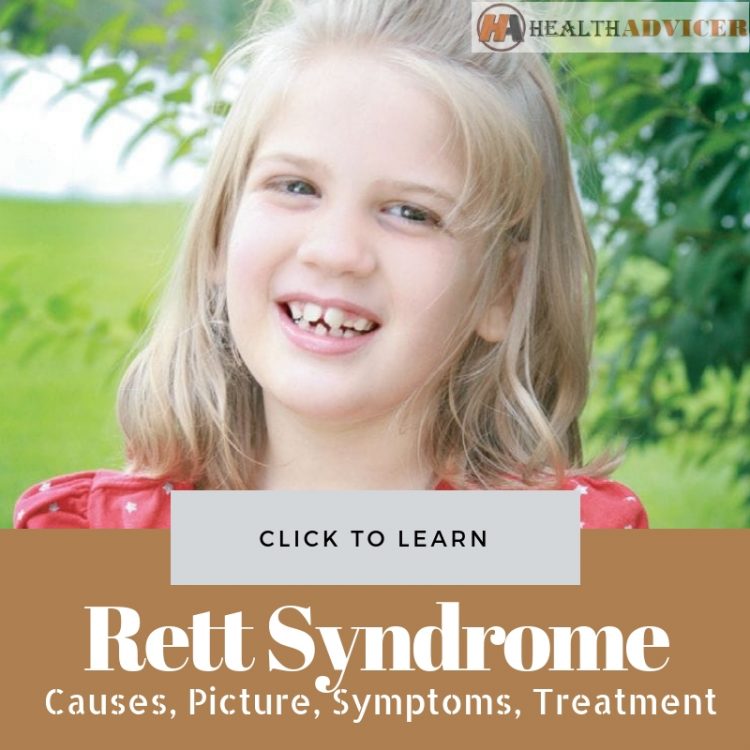 Rett Syndrome