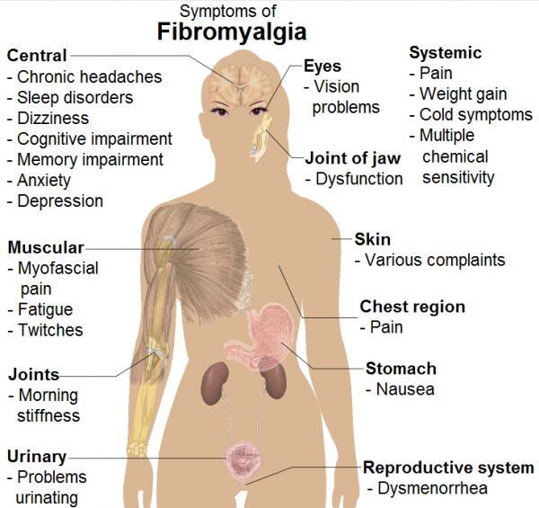 Fibromyalgia