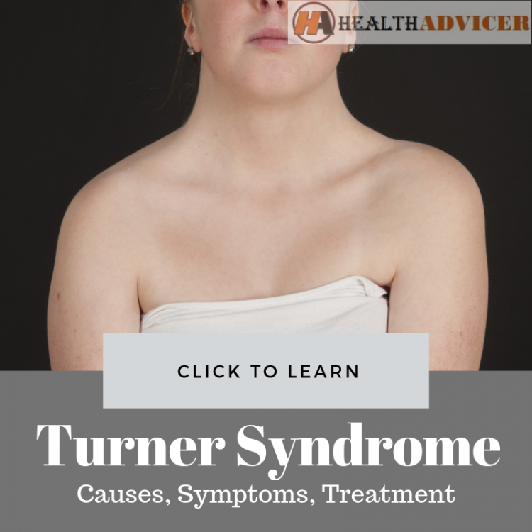 essay on turner syndrome