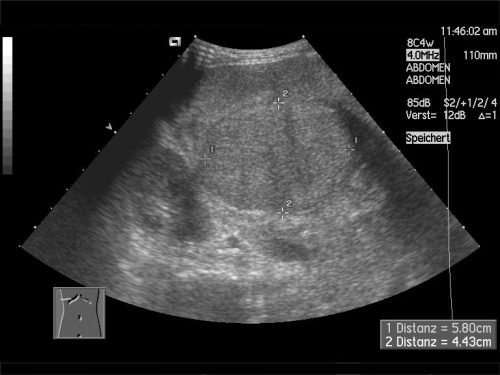 Ultrasound Test