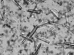 Struvite Crystals (Magnesium Ammonium Phosphate)