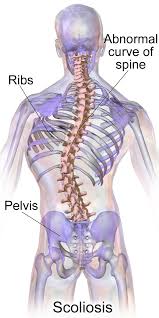 Spinal Cord Problems