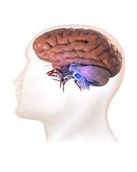 Acoustic Neuroma