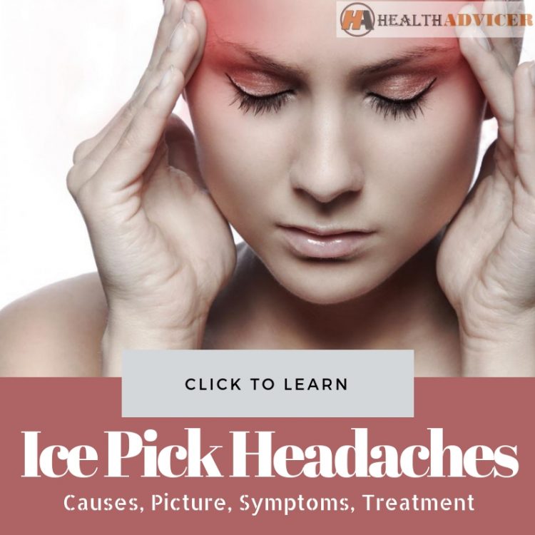 Ice Pick Headaches