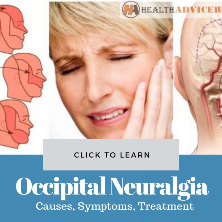 Occipital Neuralgia Causes Treatment