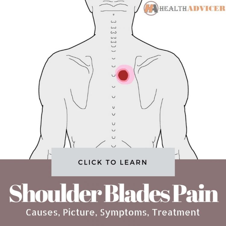 Pain Between Shoulder Blades