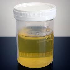 Urine