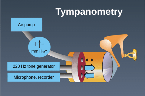 Perform Tympanometry