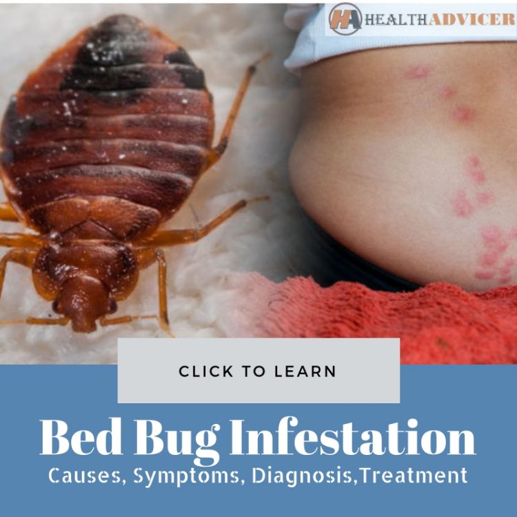 Bed Bug Infestation Picture