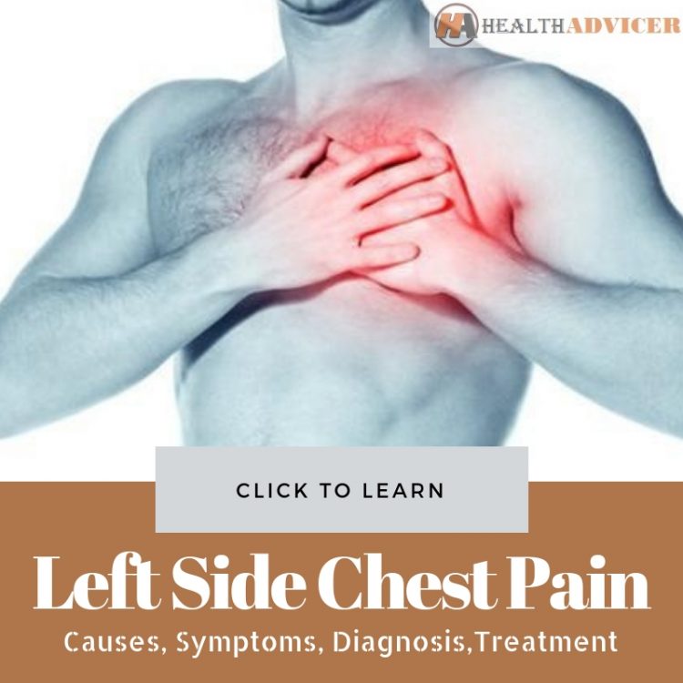 Left Side Chest Pain picture