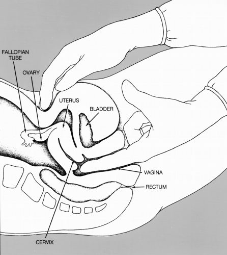 Pelvic Examination