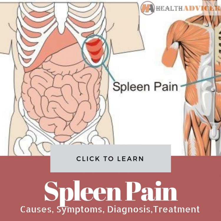 Spleen Pain Picture