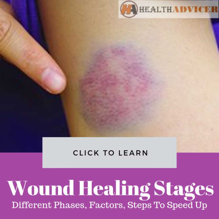 Wound Healing Stages