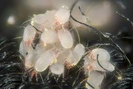 Dust Mite Allergy