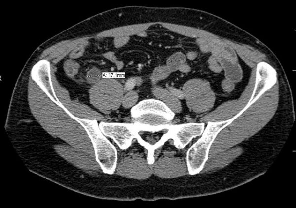 Imaging tests