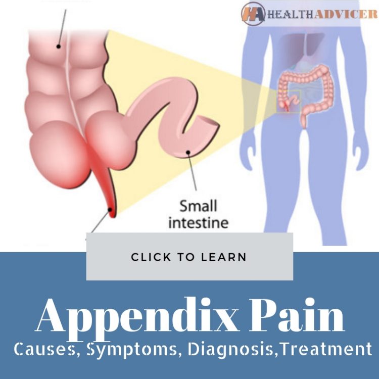 Appendix Pain: Causes, Location, Symptoms, And Treatment