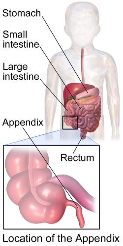 Appendicitis In Kids