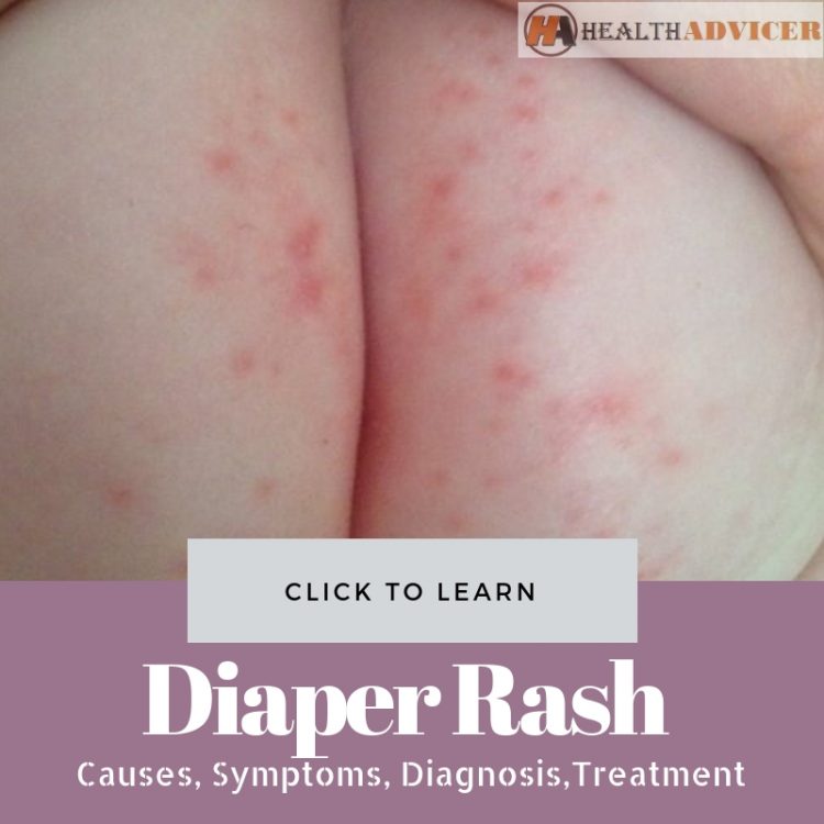 Diaper Rash Picture causes