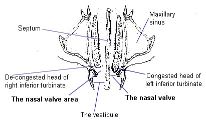 nasal congestion