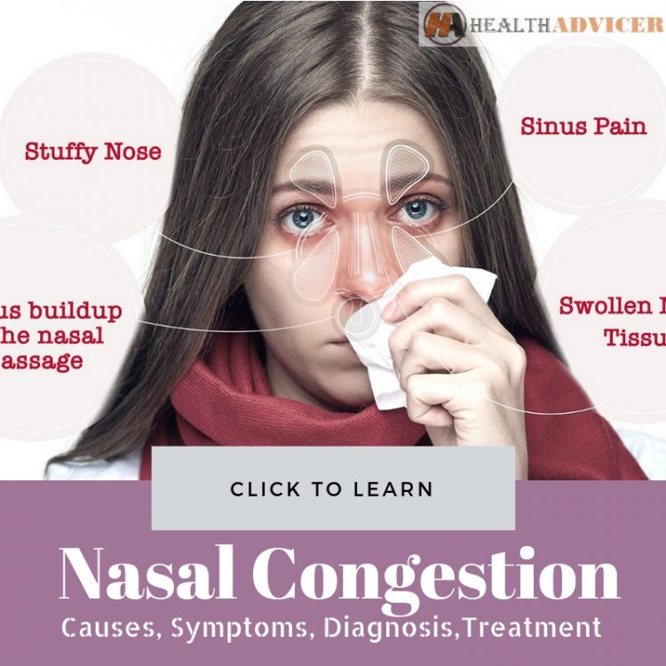 Nasal Congestion