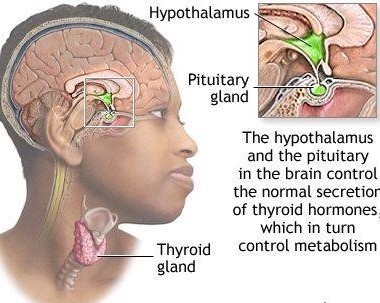 What Is Goiter