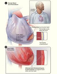 Heart And Blood Vessel Problems