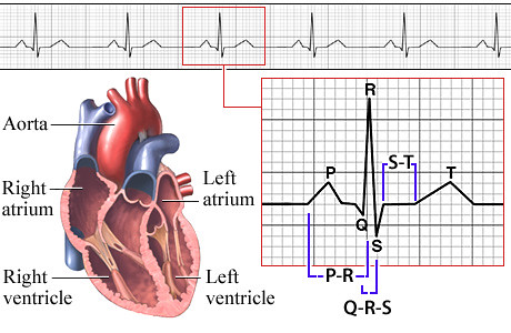 Electrocardiogram (EKG)