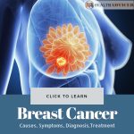 Breast Cancer