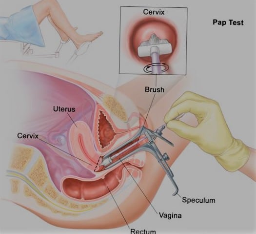 Pap Test