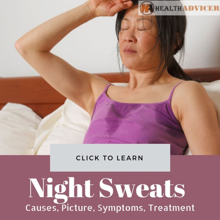 Night Sweats Cause treatment