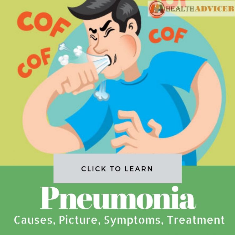 Pneumonia Causes picture treatment