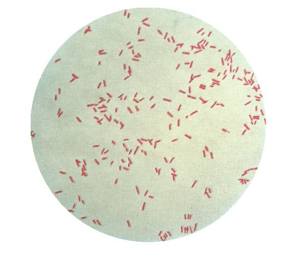 Pseudomonas aeruginosa