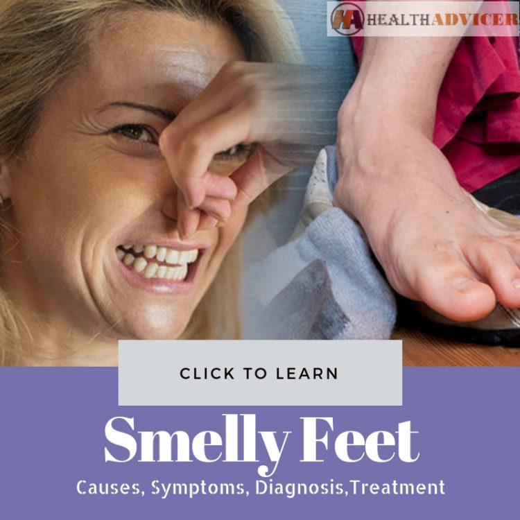 Smelly Feet Causes Treatment