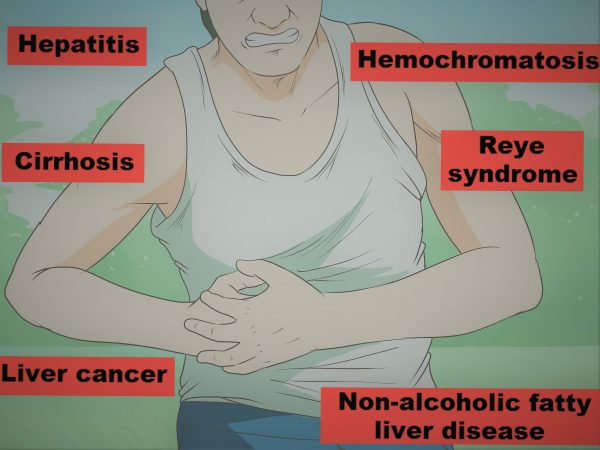 Causes Associated With Liver Pain