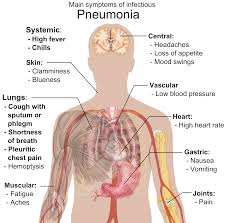 Symptoms Of Pneumonia