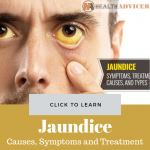Jaundice Picture