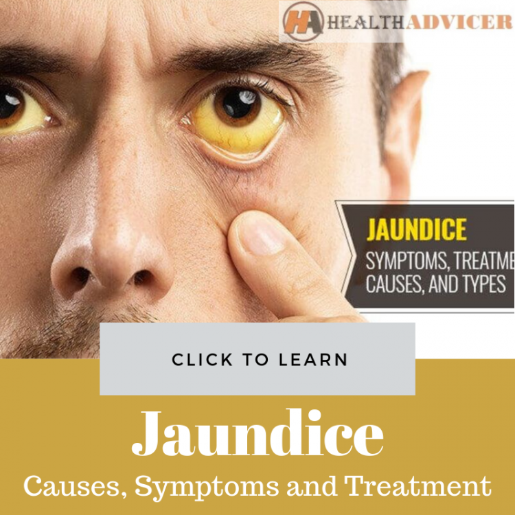 Jaundice Picture